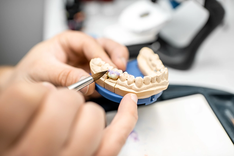 On-Site Dental Lab
