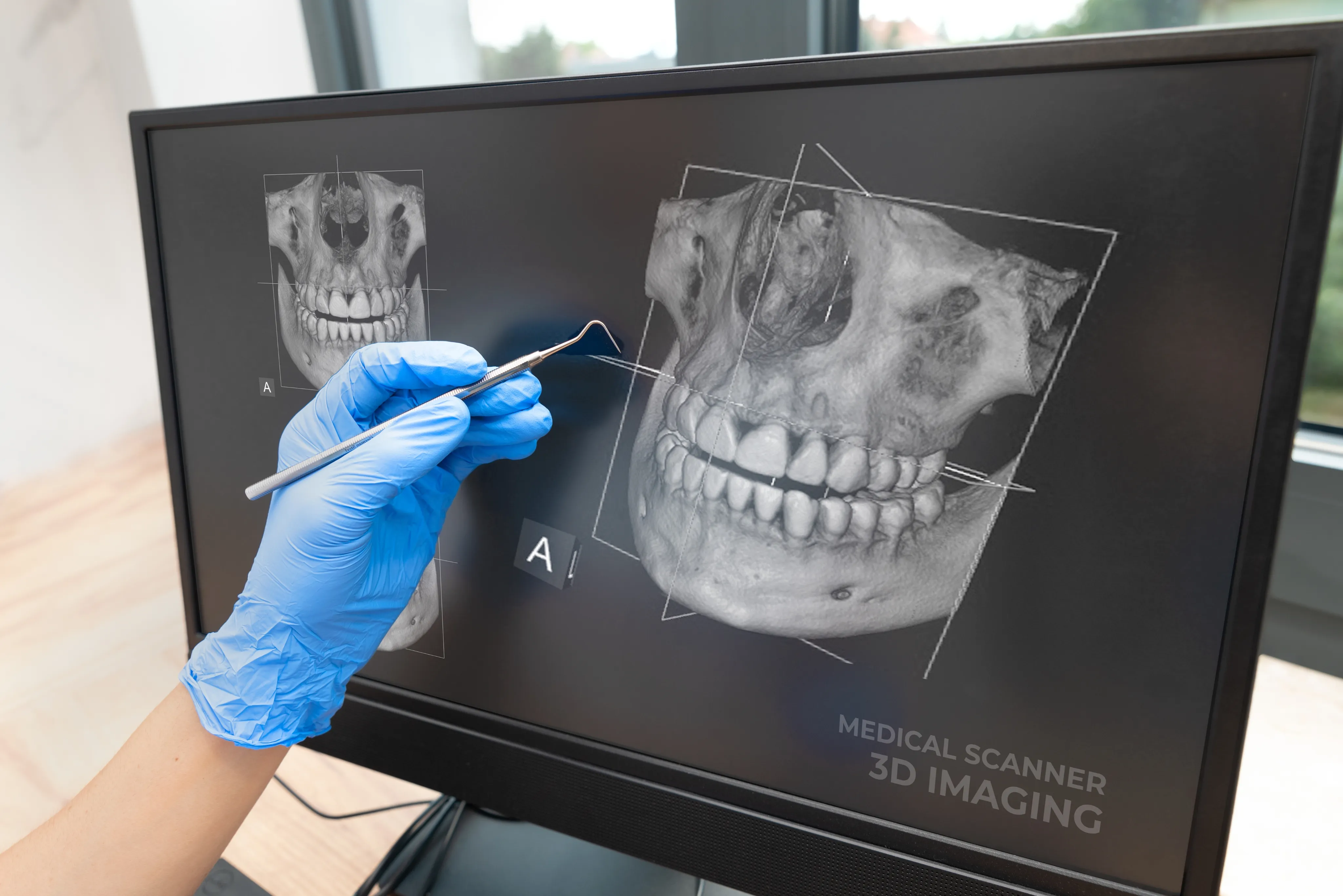 Digital X-Rays in Wheaton, IL: Clear, Fast Dental Imaging